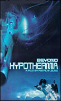 Hipotermia
